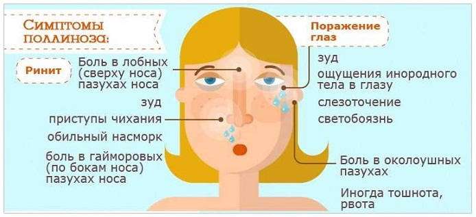 Поллиноз (сенная лихорадка) - симптомы и лечение