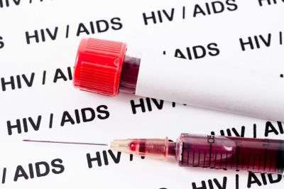 Информация о ВИЧ у пациента может быть доступна не только врачам-инфекционистам